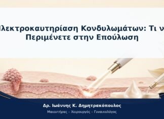 Ηλεκτροκαυτηρίαση Κονδυλωμάτων: Τι να Περιμένετε στην Επούλωση