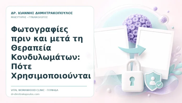 Φωτογραφίες πριν και μετά τη Θεραπεία Κονδυλωμάτων: Πότε Χρησιμοποιούνται - Δρ. Ιωάννης Δημητρακόπουλος, Γυναικολόγος Γλυφάδα