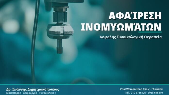 Αφαίρεση Ινομυωμάτων: Όσα Πρέπει να Γνωρίζετε Αφαίρεση Ινομυωμάτων - Δρ. Ιωάννης Δημητρακόπουλος