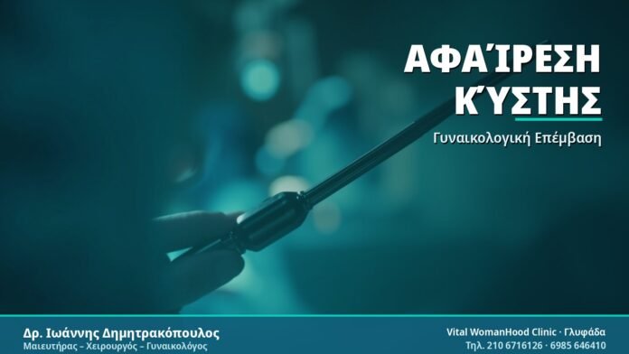 Αφαίρεση Κύστης - Δρ. Ιωάννης Δημητρακόπουλος