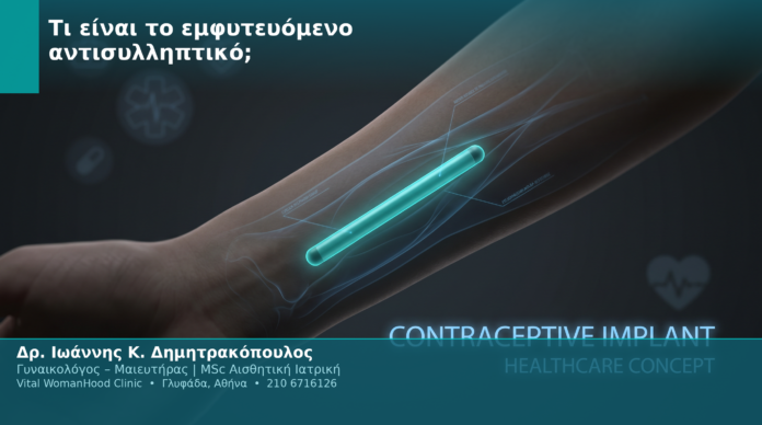 Τι είναι το εμφυτευόμενο αντισυλληπτικό; Τι είναι το εμφυτευόμενο αντισυλληπτικό;