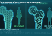 Τι είναι η οστεοπόρωση στην εμμηνόπαυση;