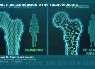 Τι είναι η οστεοπόρωση στην εμμηνόπαυση;