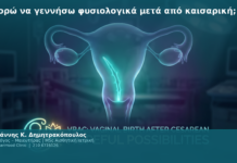 Μπορώ να γεννήσω φυσιολογικά μετά από καισαρική;