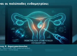 Τι είναι οι πολύποδες ενδομητρίου;