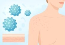 Η σημασία της διαφορικής διάγνωσης στα HPV κονδυλώματα Αφηρημένη σύγχρονη ιατρική απεικόνιση του ιού HPV και δερματολογικά μοτίβα σε φωτεινό ιατρικό περιβάλλον