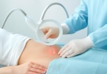 Καθοδηγούμενη Laser Θεραπεία για Κονδυλώματα HPV στη Γυναίκα: Αποτελεσματικότητα και Ασφάλεια Laser θεραπεία κονδυλωμάτων HPV στη γυναίκα - Εξειδικευμένη γυναικολογική διαδικασία από τον Δρ. Δημητρακόπουλο