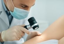 Κονδυλώματα HPV: Κλινική Εξέταση Ιατρική εξέταση κονδυλωμάτων HPV με ισχυρό φωτισμό και φακό