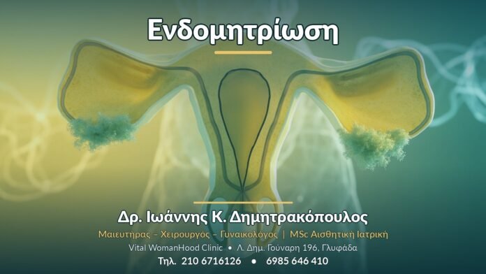 Ενδομητρίωση - Δρ. Ιωάννης Κ. Δημητρακόπουλος, Γυναικολόγος Γλυφάδα