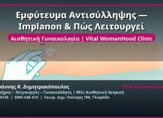 Εμφύτευμα Αντισύλληψης — Implanon & Πώς Λειτουργεί