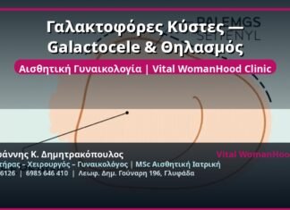 Γαλακτοφόρες Κύστες — Galactocele & Θηλασμός