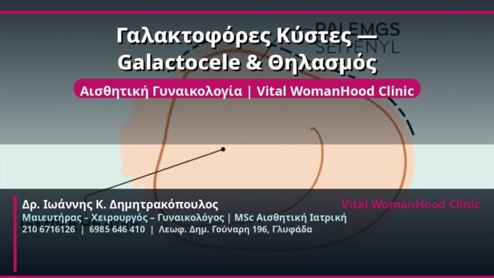 cover_galaktofores-kystes-galactocele-glyfada