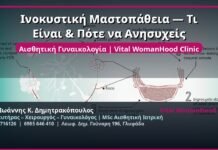 Ινοκυστική Μαστοπάθεια — Τι Είναι & Πότε να Ανησυχείς