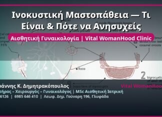 Ινοκυστική Μαστοπάθεια — Τι Είναι & Πότε να Ανησυχείς