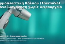 Θερμοπλαστική Κόλπου (ThermiVa) — Αναζωογόνηση χωρίς Χειρουργείο