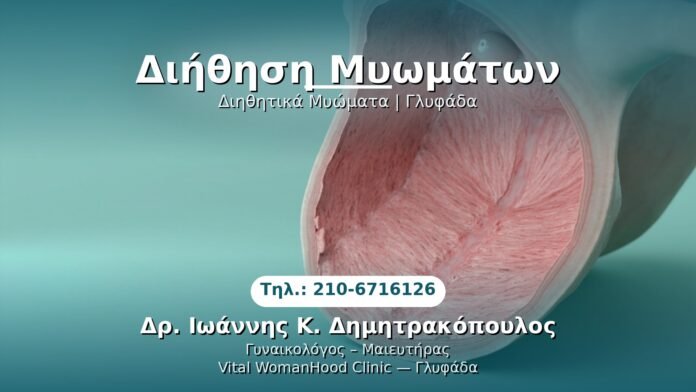 diithisi-myomaton-glyfada PRP Γυναικολογίας — Γλυφάδα | Δρ. Ιωάννης Κ. Δημητρακόπουλος