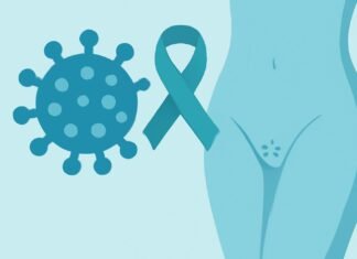 Εικονογράφηση για άρθρο σχετικά με τον HPV και τα κονδυλώματα