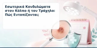 Εσωτερικά Κονδυλώματα στον Κόλπο ή τον Τράχηλο: Πώς Εντοπίζονται; – Δρ. Ιωάννης Κ. Δημητρακόπουλος
