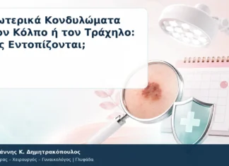 Εσωτερικά Κονδυλώματα στον Κόλπο ή τον Τράχηλο: Πώς Εντοπίζονται; Εσωτερικά Κονδυλώματα στον Κόλπο ή τον Τράχηλο: Πώς Εντοπίζονται; – Δρ. Ιωάννης Κ. Δημητρακόπουλος