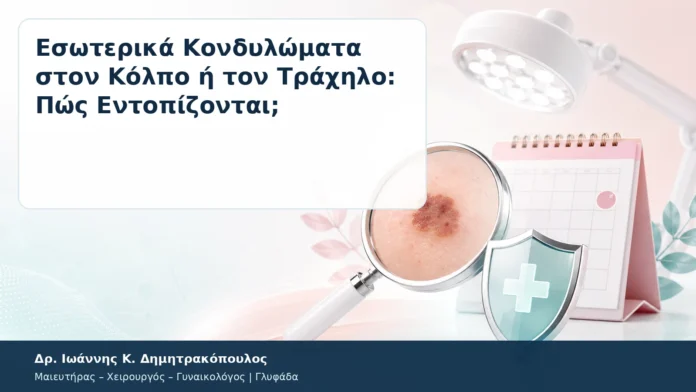 Εσωτερικά Κονδυλώματα στον Κόλπο ή τον Τράχηλο: Πώς Εντοπίζονται; Εσωτερικά Κονδυλώματα στον Κόλπο ή τον Τράχηλο: Πώς Εντοπίζονται; – Δρ. Ιωάννης Κ. Δημητρακόπουλος
