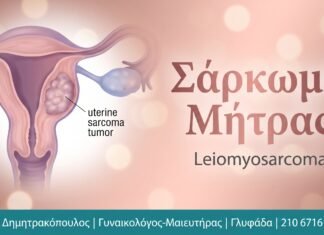 Σάρκωμα Μήτρας: Αίτια, Συμπτώματα και Θεραπεία