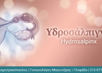 Υδροσάλπιγγα: Αιτίες και Θεραπευτικές Επιλογές