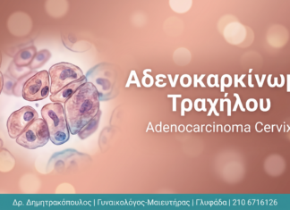 Αδενοκαρκίνωμα Τραχήλου: Διάγνωση και Θεραπεία