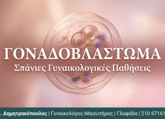 Γοναδοβλάστωμα: Αίτια και Θεραπεία