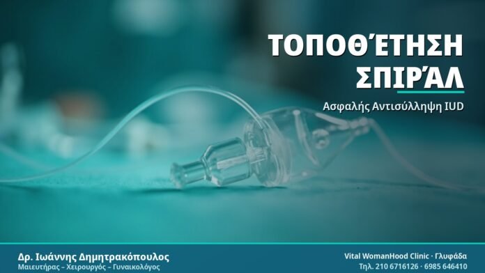 Τοποθέτηση Σπιράλ IUD: Όλα όσα πρέπει να γνωρίζετε Τοποθέτηση Σπιράλ - Δρ. Ιωάννης Δημητρακόπουλος
