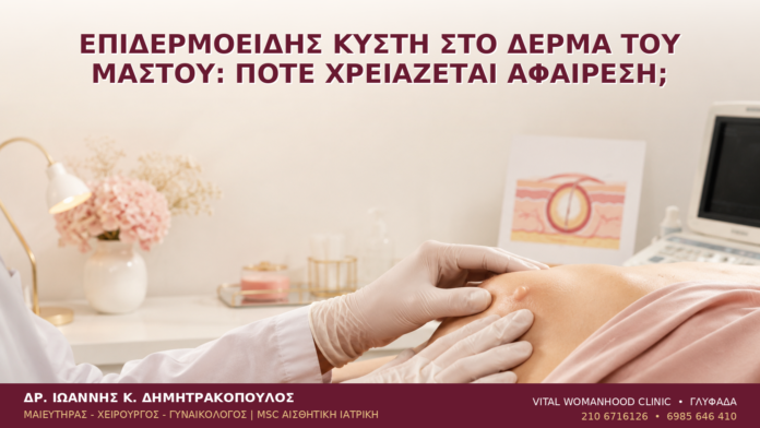 Επιδερμοειδής Κύστη στο Δέρμα του Μαστού: Πότε Χρειάζεται Αφαίρεση; Επιδερμοειδής Κύστη στο Δέρμα του Μαστού: Πότε Χρειάζεται Αφαίρεση; - Δρ. Ιωάννης Κ. Δημητρακόπουλος