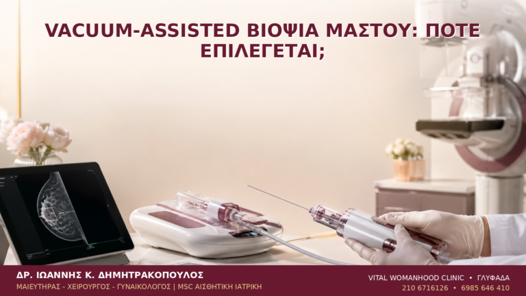 Vacuum-Assisted Βιοψία Μαστού: Πότε Επιλέγεται; - Δρ. Ιωάννης Κ. Δημητρακόπουλος