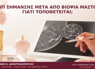 Κλιπ Σήμανσης μετά από Βιοψία Μαστού: Γιατί Τοποθετείται; Κλιπ Σήμανσης μετά από Βιοψία Μαστού: Γιατί Τοποθετείται; - Δρ. Ιωάννης Κ. Δημητρακόπουλος