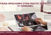 Τυχαία Πρόσληψη στον Μαστό σε PET/CT: Τι Σημαίνει; Τυχαία Πρόσληψη στον Μαστό σε PET/CT: Τι Σημαίνει; - Δρ. Ιωάννης Κ. Δημητρακόπουλος