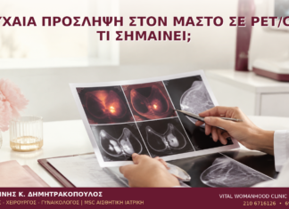 Τυχαία Πρόσληψη στον Μαστό σε PET/CT: Τι Σημαίνει; - Δρ. Ιωάννης Κ. Δημητρακόπουλος