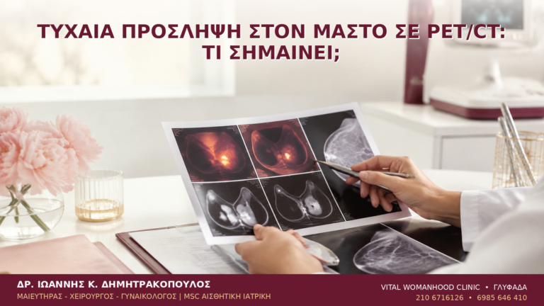 Τυχαία Πρόσληψη στον Μαστό σε PET/CT: Τι Σημαίνει; - Δρ. Ιωάννης Κ. Δημητρακόπουλος