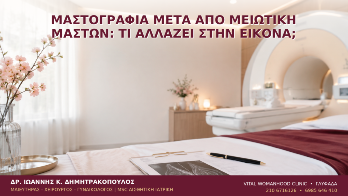Μαστογραφία μετά από Μειωτική Μαστών: Τι Αλλάζει στην Εικόνα; - Δρ. Ιωάννης Κ. Δημητρακόπουλος