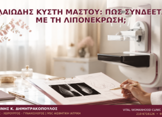 Ελαιώδης Κύστη Μαστού: Πώς Συνδέεται με τη Λιπονέκρωση; Ελαιώδης Κύστη Μαστού: Πώς Συνδέεται με τη Λιπονέκρωση; - Δρ. Ιωάννης Κ. Δημητρακόπουλος