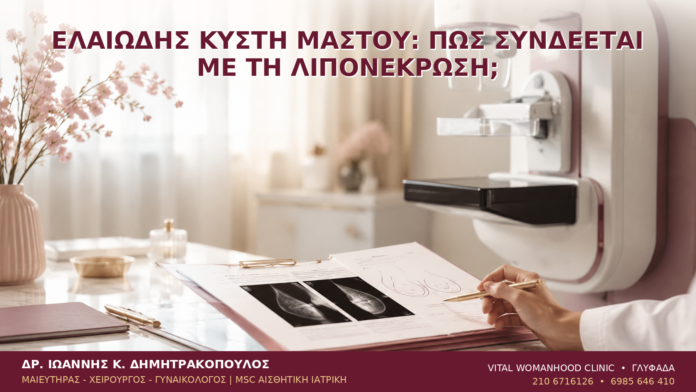 Ελαιώδης Κύστη Μαστού: Πώς Συνδέεται με τη Λιπονέκρωση; Ελαιώδης Κύστη Μαστού: Πώς Συνδέεται με τη Λιπονέκρωση; - Δρ. Ιωάννης Κ. Δημητρακόπουλος