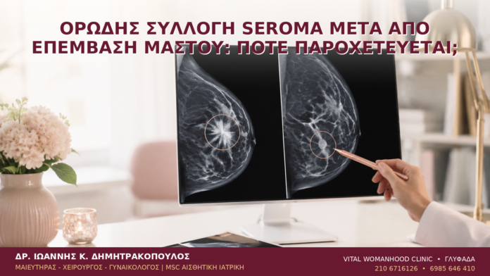 Ορώδης Συλλογή Seroma μετά από Επέμβαση Μαστού: Πότε Παροχετεύεται; - Δρ. Ιωάννης Κ. Δημητρακόπουλος