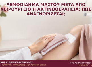 Λεμφοίδημα Μαστού μετά από Χειρουργείο ή Ακτινοθεραπεία: Πώς Αναγνωρίζεται; - Δρ. Ιωάννης Κ. Δημητρακόπουλος