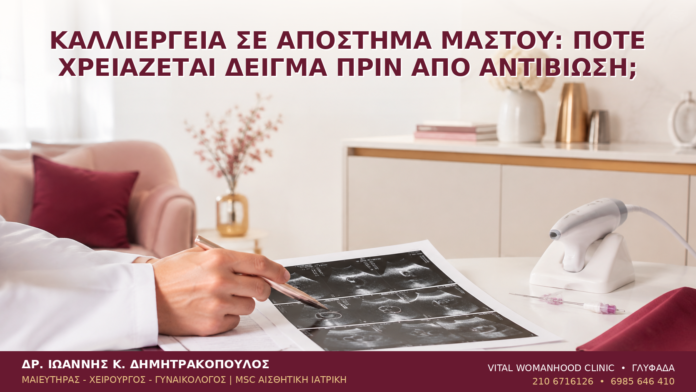 Καλλιέργεια σε Απόστημα Μαστού: Πότε Χρειάζεται Δείγμα πριν από Αντιβίωση; - Δρ. Ιωάννης Κ. Δημητρακόπουλος