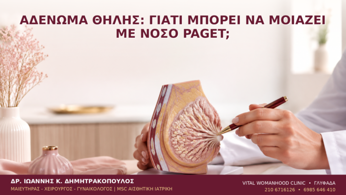 Αδένωμα Θηλής: Γιατί Μπορεί να Μοιάζει με Νόσο Paget; - Δρ. Ιωάννης Κ. Δημητρακόπουλος