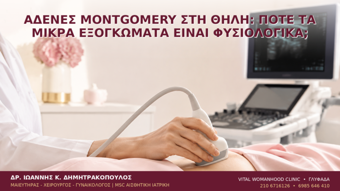 Αδένες Montgomery στη Θηλή: Πότε τα Μικρά Εξογκώματα Είναι Φυσιολογικά; Αδένες Montgomery στη Θηλή: Πότε τα Μικρά Εξογκώματα Είναι Φυσιολογικά; - Δρ. Ιωάννης Κ. Δημητρακόπουλος