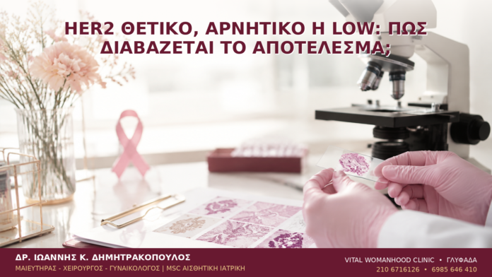 HER2 Θετικό, Αρνητικό ή Low: Πώς Διαβάζεται το Αποτέλεσμα; HER2 Θετικό, Αρνητικό ή Low: Πώς Διαβάζεται το Αποτέλεσμα; - Δρ. Ιωάννης Κ. Δημητρακόπουλος