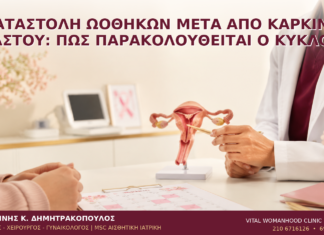 Καταστολή Ωοθηκών μετά από Καρκίνο Μαστού: Πώς Παρακολουθείται ο Κύκλος; - Δρ. Ιωάννης Κ. Δημητρακόπουλος