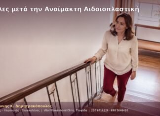 Σκάλες μετά την Αναίμακτη Αιδοιοπλαστική