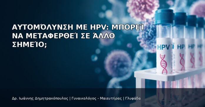 Αυτομόλυνση με HPV: Μπορεί να Μεταφερθεί σε Άλλο Σημείο; Αυτομόλυνση με HPV: Μπορεί να Μεταφερθεί σε Άλλο Σημείο; - Δρ. Ιωάννης Δημητρακόπουλος