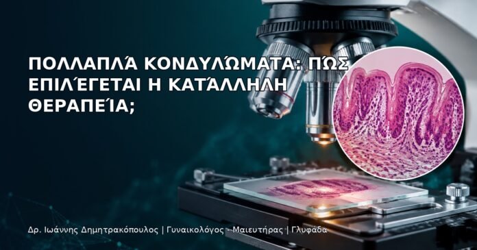Πολλαπλά Κονδυλώματα: Πώς Επιλέγεται η Κατάλληλη Θεραπεία; Πολλαπλά Κονδυλώματα: Πώς Επιλέγεται η Κατάλληλη Θεραπεία; - Δρ. Ιωάννης Δημητρακόπουλος