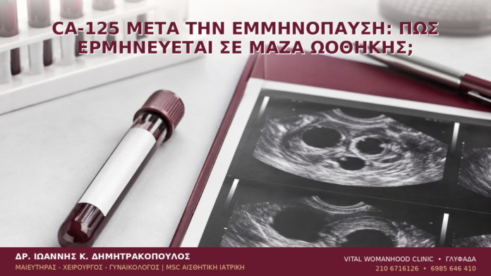 CA-125 μετά την Εμμηνόπαυση: Πώς Ερμηνεύεται σε Μάζα Ωοθήκης; CA-125 μετά την Εμμηνόπαυση: Πώς Ερμηνεύεται σε Μάζα Ωοθήκης; - Δρ. Ιωάννης Κ. Δημητρακόπουλος