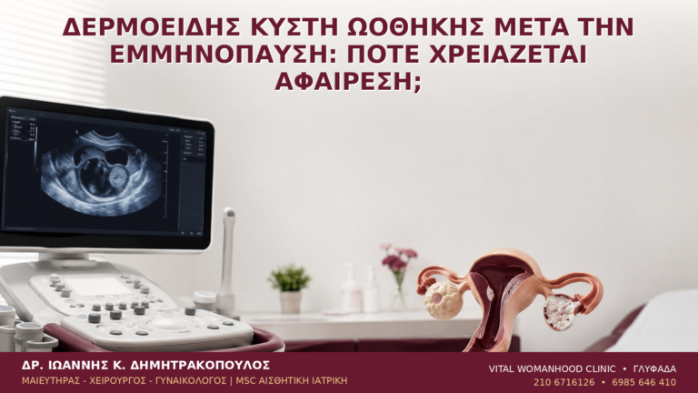 Δερμοειδής Κύστη Ωοθήκης μετά την Εμμηνόπαυση: Πότε Χρειάζεται Αφαίρεση; - Δρ. Ιωάννης Κ. Δημητρακόπουλος